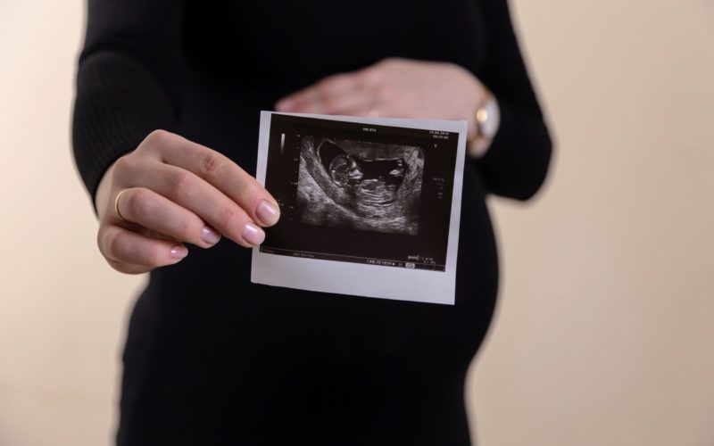 Une soignante face au cauchemar de l’avortement tardif