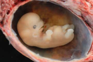 Quand l’embryon redevient un bébé